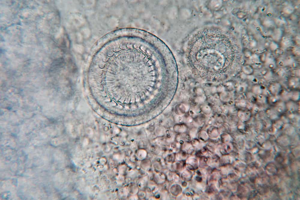 Gills of fish ,protozoa and Trichodina