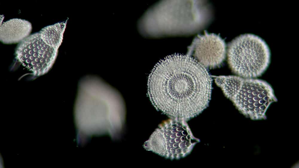 microscopy of a sampling of diatoms, microalgae, jewels of the sea